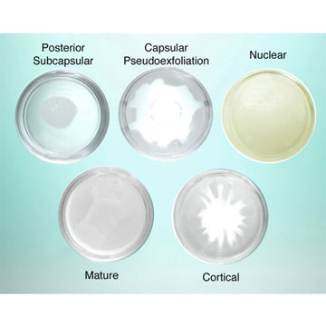 Cataract Eye Model Lenses