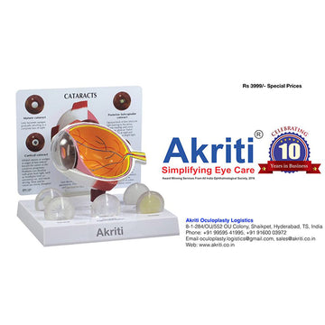 Cornea Eye Model