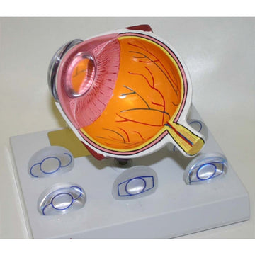 Intra Ocular Lens Model and IOL Lenses