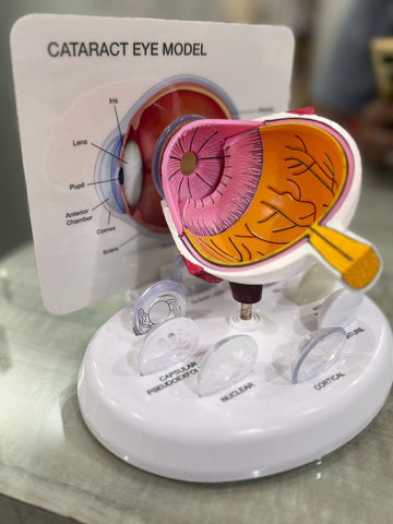 Cataract  Eye Model