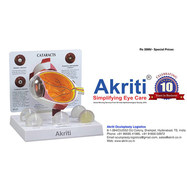 Cornea Eye Model